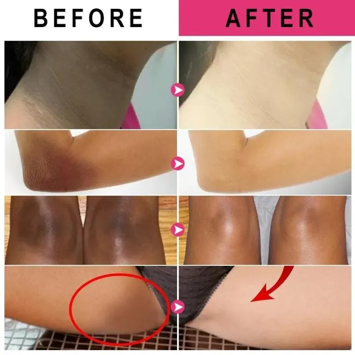 Body%20Brightening%20Cream%20Lightening%20Elbow%20and%20Knee%20Joint%20Black%20Exfoliating%20Cream%20Improving%20Dark%20Inner%20Thigh%20Skin%20Under%20Armpit%20-%20Image%204