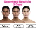 Yana Beauty Intimate Private Parts whitening & Brightening Night Cream For Boys(30G)(FROM INDIA)NUZ. 