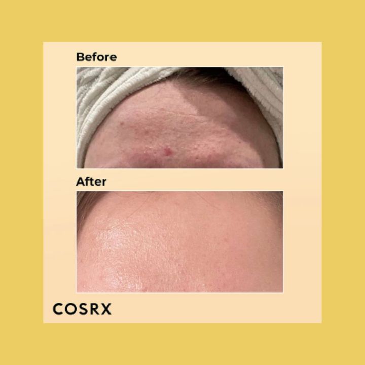 COSRX%20Advanced%20Snail%2096%20Mucin%20Power%20Essence%20100ml%20with%20a%20Free%20Peptide%20132%20Ultra%20Perfect%20Hair%20Bonding%20Sampoo%20&%20%20Ultra%20Perfect%20Hair%20Bonding%20Treatment%20-%20Image%206