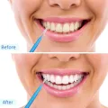 10 PCS Toothpick Teeth Plaque Remove Interdental Brushes Oral Care Hygienic Soft Rubber Bristle Teeth Cleaning Elastic brush With Thread Orthodontic Brush,Teeth Care Dental Floss Teeth Gaps Professional Deep Oral Teeth Cleaning Tools. 