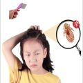 Lice Comb Head Lice Comb for Long & Short Hair Efficient Lice and Nit Removal Hair Dandruff Comb. 