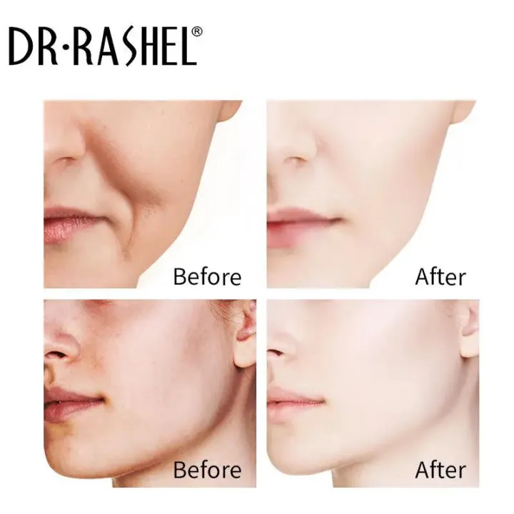 DR.RASHEL%20-%203%20In%201%20Complete%20Facial%20Serum%20Set%20Vitamin%20C%20Serum%20Hyaluronic%20Acid%20Serum%20Retinol%20Serum%20-%20Image%206