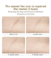LANBENA TCM Scar & Acne Mark Removal Gel Ointment - 30g. 