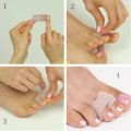 Delysia King 2 Pcs Toe separator finger corrector. 