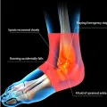 Ankle Support - Adjustable Foot Care Compression Ankle Sleeve Support with Pressurized Joint Socks - Jingba Support. 