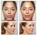 Finishing touch Flawless Dermaplane  Lady Razor Shaver Painless Exfoliates Dead Skin Tool. 