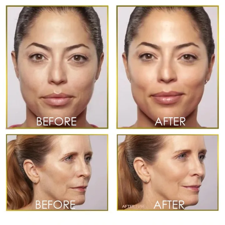 Finishing%20touch%20Flawless%20Dermaplane%20%20Lady%20Razor%20Shaver%20Painless%20Exfoliates%20Dead%20Skin%20Tool%20-%20Image%207