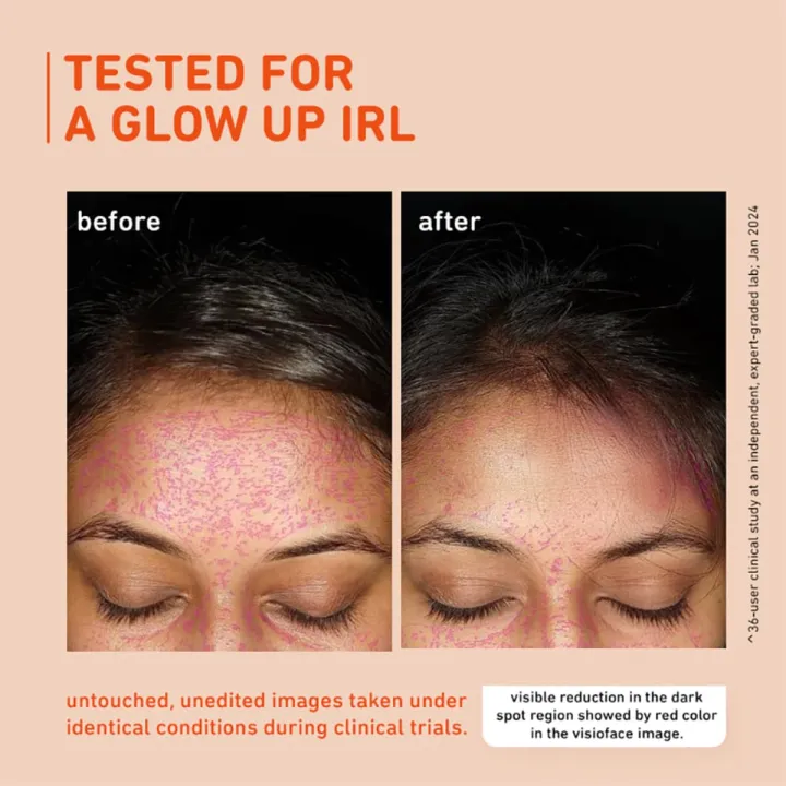 Plum%2015%25%20Vitamin%20C%20Face%20Serum%2020%20ml%20-%20Image%206