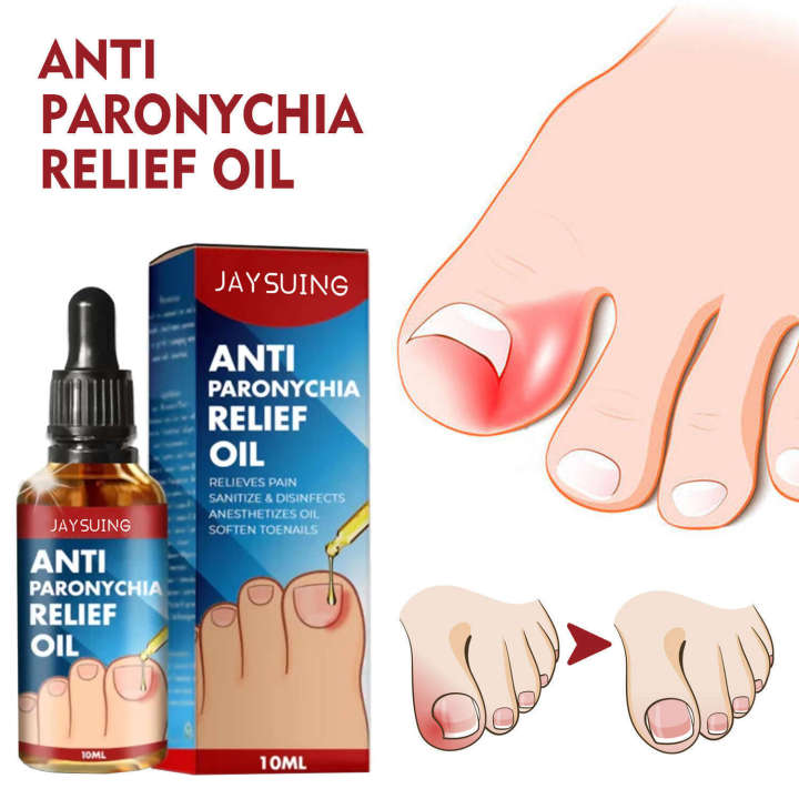 Jaysuing%20Soft%20Brightening%20Repair%20Ingrown%20Toenail%20Thickening%20Type%20Gray%20Nail%20Care%20Essence%20Oil%20-%20Image%202
