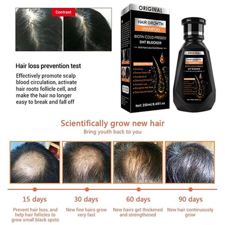 Essential%20Oil%20Biotin%20Cold-Pressed%20DHT%20Blocker%20-Hair%20Shampoo%20And%20Hair%20Accessories%20Loss%20Growth%20Hair%20Condition%20C7Y1%20-%20Image%206