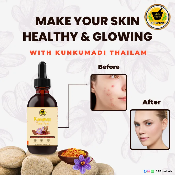AF%20Herbals%20Kunkumadi%20Thailam%20-%20Image%203