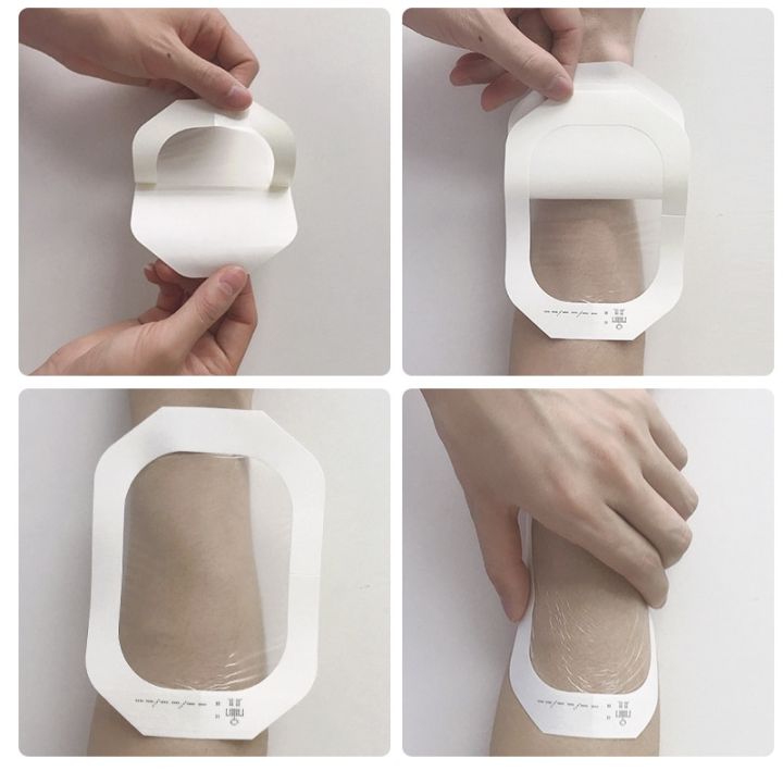 plasters%20medical%20100Pcs%20Medical%20Waterproof%20Surgical%20Adhesive%20PU%20Film%20Wound%20Dressing%20I.V.%20Cannula%20Indwelling%20Needle%20Catheter%20Fixation%20StickerFirst%20Aid%20Kits%20-%20Image%205