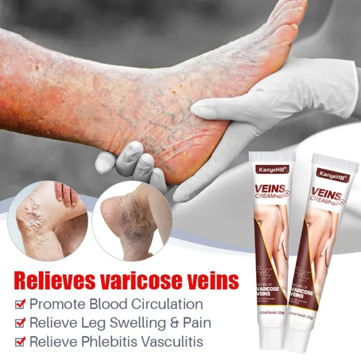 20g%20Relaxing%20Leg%20Cream%20Eliminate%20Vasculitis%20Phlebitis%20Spider%20Vein%20Care%20Leg%20Cream%20Improves%20Blood%20Circulation%20Anti%20Varicose%20Cream%20-%20Image%204