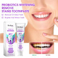 【Popular Categories】 Oralhoe 120g Sp7 Toothpaste Bleach Yellow Teeth Relieve Swollen Gum Fresh Breath Repair Decay Whiten Tooth Toothpaste. 