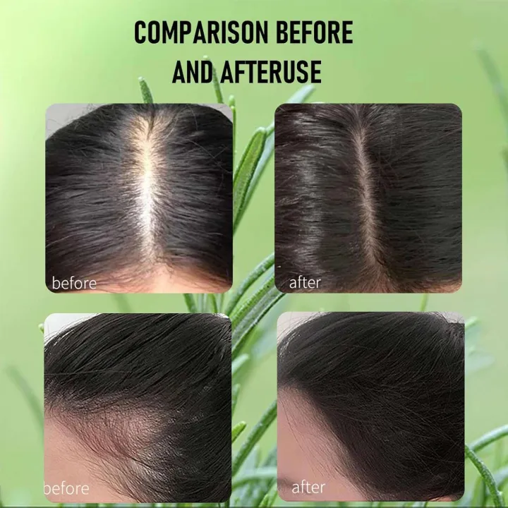 Heykeratin%20Oil,%20Hey%20Keratin%20Natural%20Hair%20Growth%20Oil%20Black%20Women,%20HairOil%20Rosemary%20Drops%20for%20Dry%20Damaged%20Hair(2%20bottles)%20-%20Image%204