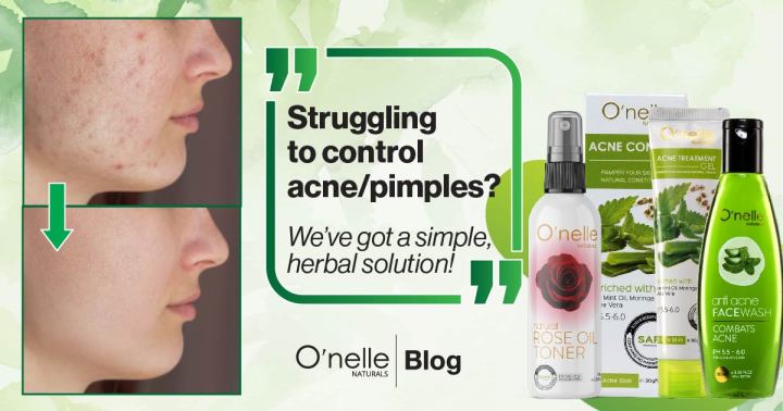 O'nelle%20Naturals%20Acne%20Control%20Face%20Wash%20100Ml%20-%20Image%204