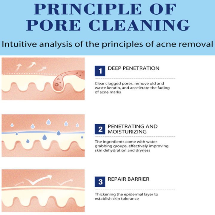 Salicylic%20Acid%20Acne%20Treatment%20Cream%20Acne%20Remover%20Face%20Cream%20Remove%20Deep%20Acne%20Scars%20Gel%20Oil%20Control%20Shrink%20Pores%20Blackheads%20Care%20-%20Image%203
