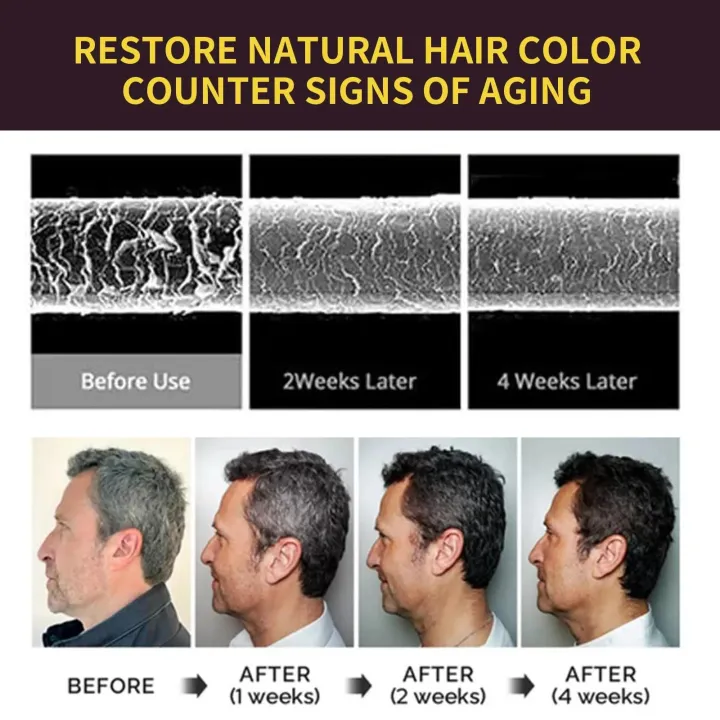 Black%20Hair%20Dye%20Shampoo%20White%20Hair%20Dye%20To%20Black%20Shampoo%20Activate%20Hair%20Follicle%20Melanin%20White%20Treatment%203%20In%201%20For%20Men%20Women%20-%20Image%203