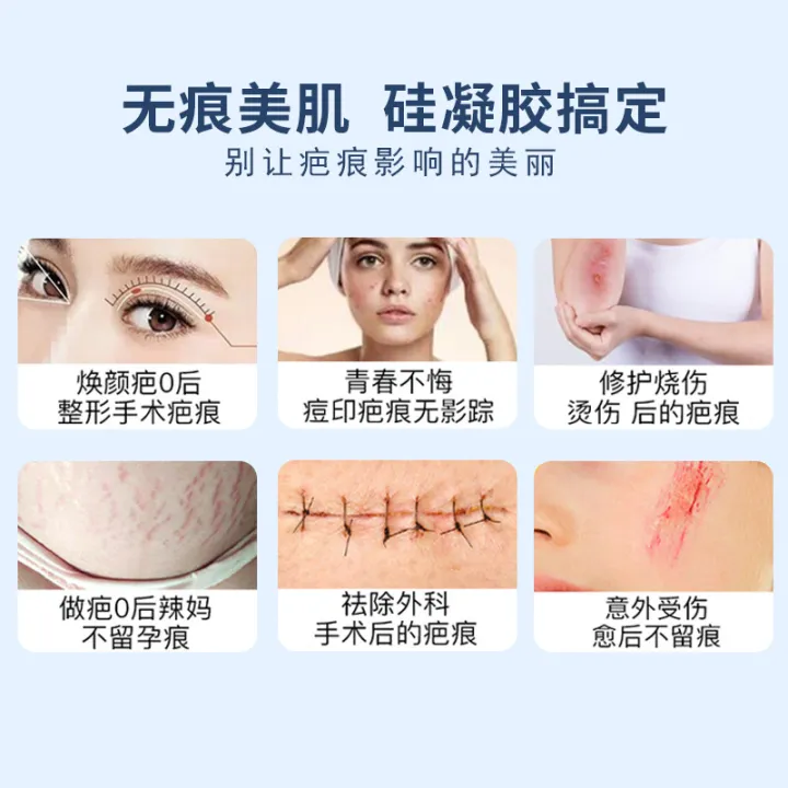 Turneng%20self-drying%20silicone%20gel%20scar%20removal%20cream%20repairs%20scar%20removal%20cream%20to%20fade%20hypertrophic%20scars%20from%20surgical%20burns%20and%20scalds%20-%20Image%205