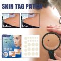 Skin Tags Removal Patches - 144pcs. 