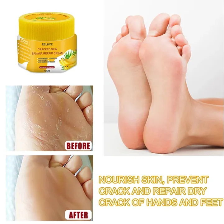 Foot%20crack%20repair%20and%20dryness%20healing%20cream%2020g%20big%20pack%20Natural%20ingredients%20-%20Image%204