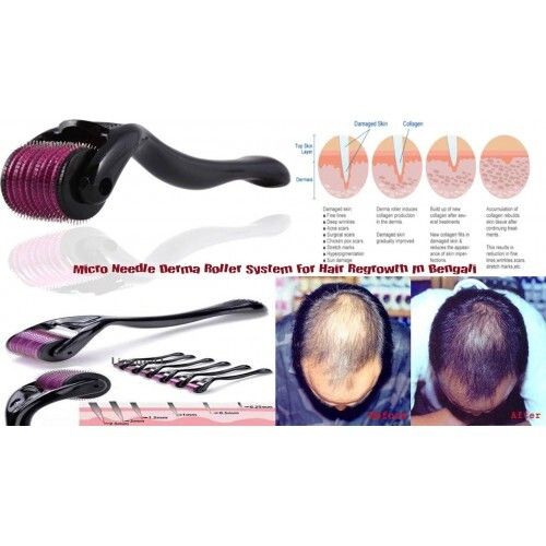 Professional%20Micro%20Needle%20Roller%20Beard%20Regeneration%20Care,%20Titanium%20Microneedle%20Roller%20Dermaroller%20Micro%20Needle%20Skin%20Care%200.25mm%200.5mm%200.75mm%201mm%201.5mm%202mm%202.5mm%203mm%20Dermaroller%20Derma%20-%20Image%206