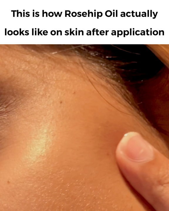 %20Cliara%20Rosehip%20Oil%2030%20Ml%20-%20Image%209