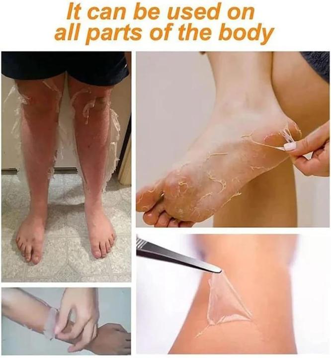 Underarm%20Strong%20Yellow%20Peeling%20Oil%20Extra%20Strength%20for%20Dark%20Body%20Skin,Hyaluronate%20Exfoliating%20for%20All%20Skin%20Type%20-%20Image%203