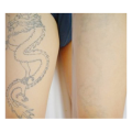 Permanent Tattoo Removal Cream Safe Removing Maximum Strength Cleaning. 