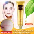 TCM Scar and Acne Mark Removal Gel Oinment. 