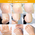 Frank Body Cleansing Oil|disaar Hyaluronic Acid Exfoliating Body Scrub - Vitamin C Whitening Lotion. 