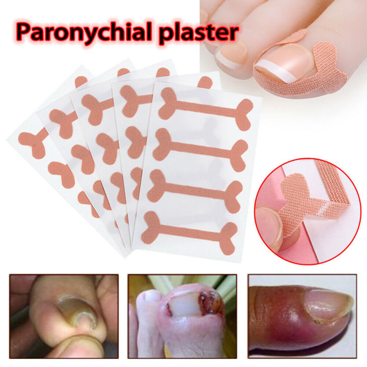 plasters%20medical%2012%20s%20Ingrown%20Toenails%20Band%20Aid%20Relief%20Pain%20Paronychia%20Correction%20Pedicure%20Elastic%20Force%20Sticker%20Repair%20Bandage%20Toe%20Nail%20CareFirst%20Aid%20Kits%20-%20Image%203