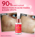 Outshine – Korean Brightening Face Serum. 