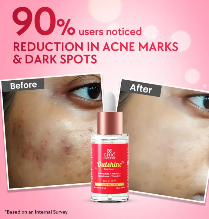 Outshine%20%E2%80%93%20Korean%20Brightening%20Face%20Serum%20-%20Image%203