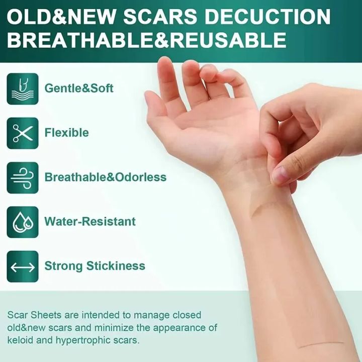 1%20Roll%20Reusable%20Scars%20Removal%20Sheets,Silicone%20Scars%20Sheets%20Tape%20for%20Surgical%20Scars,Healing%20Keloid,C-Section,Tummy%20Tuck,Burn,Acne%20-%20Image%203