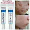 Natural Ingredient BIOAQUA PURE SKIN Anti Acne Scar Mark Remove Oil Control Shrink Pores Remove Pimples Blackhead Anti-Wrinkle Treatment Removal CREAM Spots Scar Blemish Marks fcca. 
