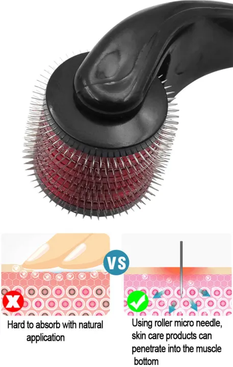 540%20Titanium%20Microneedle%200.5mm%20Derma%20Roller%20-%20Image%205