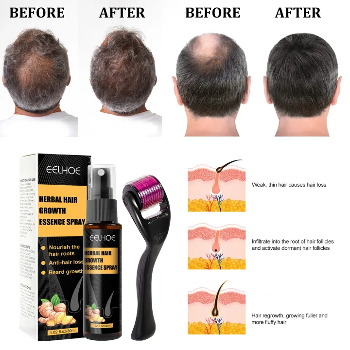 Good%20day%20minoxidil%20hair%20growth%20original%20dr%20hair%20plus%20original%20hair%20grower%20for%20men%20original%20hair%20grower%20for%20women%20effective%20hair%20growth%20for%20women%20minoxteride%20hair%20growth%20biora%20minoxteride%20hair%20growth%20newmo%20hair%20growth%20spray%20japan%20hair%20grower%20japanese%20alika%20-%20Image%204