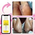 Underarm Strong Yellow Peeling Oil Extra Strength for Dark Body Skin,Hyaluronate Exfoliating for All Skin Type. 