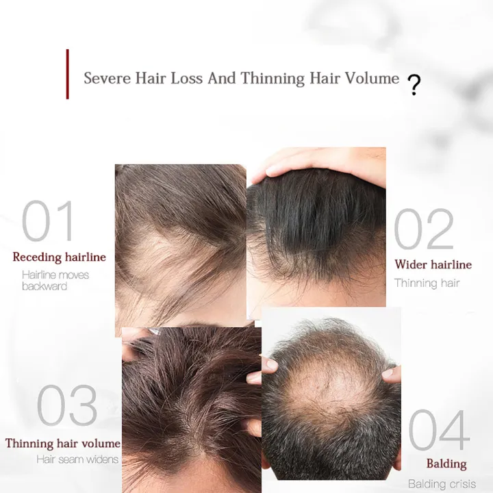 1pc%20Comb%20HF%20High%20Frequency%20Electrode%20High%20Frequency%20Electrotherapy%20Voilet%20Wand%20Acne%20Treatment%20Anti%20Hair%20Loss%20Scalp%20Massage%20Comb%20-%20Image%204