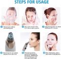 USB Rechargeable Electric Multifunctional Cleaning Instrument For acne, pimple skin treatment Blackhead Remover, Vacuum Acne, Acne Treatment, Cleaner Pore, Pore Shrinking Machine (Mfci). 