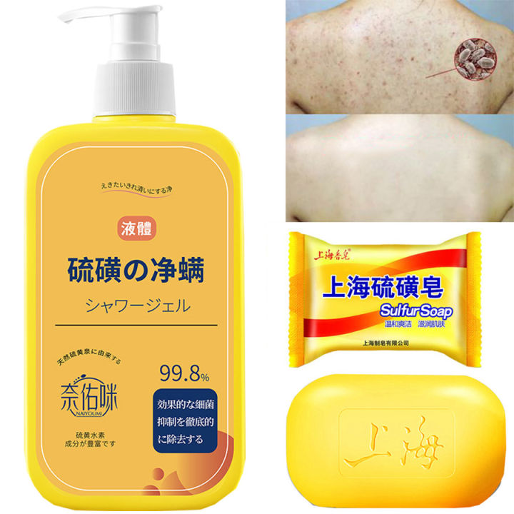 400ml%20Shower%20Gel%20Sulfur%20Liquid%20Mite%20Removal%20Soap%20Cleaner%20Bar%20Soap%20Acne%20Treatment%20Reduce%20Oil%20Keeps%20Pores%20Cleaner%20Hand%20Sulfur%20Soap%20-%20Image%202