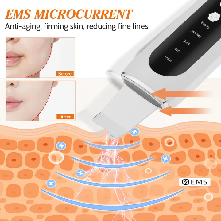 Ultrasonic%20Skin%20Scrubber%20Facial%20Cleaner%20Peeling%20Cavitation%20Machine%20EMS%20Microcurrent%20for%20Face%20Lifting%20Massager%20Blackhead%20Remover%20-%20Image%204