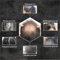 Hair Darkening Shampoo Bar for Gray Hair Coverage Soap Polygonum Multiflorum Fast Effective Repair Gray White Color Dye For Men. 