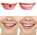 Resin Tooth Repair Glue Shapeable Teeth Gaps Filling Solid Glue Temporary Teeth Repair Falseteeth Glue Safety Dental Supplies 10g. 
