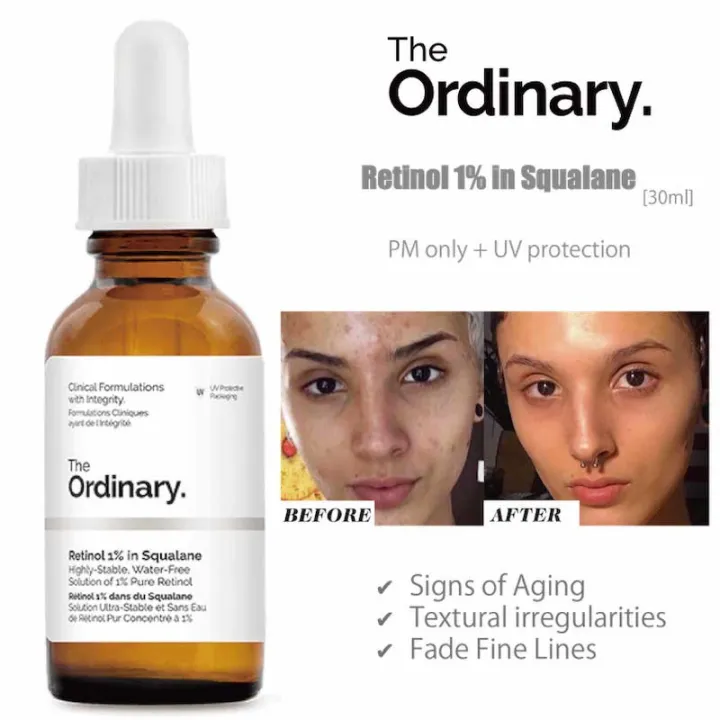 The%20ORDINARY%20Retinol%201%25%20in%20Squalane%2030ml%20Face%201sq%20%20Serum%20Made%20in%20Canada%20Minimize%20Pores%20Wrinkles%20-%20Image%203