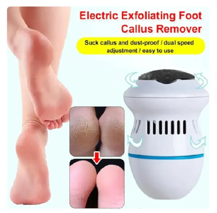 Electric%20Feet%20Sander%20Machine%20Rupture%20Skin%20Trimmer%20Dead%20Skin%20for%20Heels%20Foot%20Care%20Grinding%20Pedicure%20Tools%20Recharge%20Remover%20Callus%20-%20Image%202
