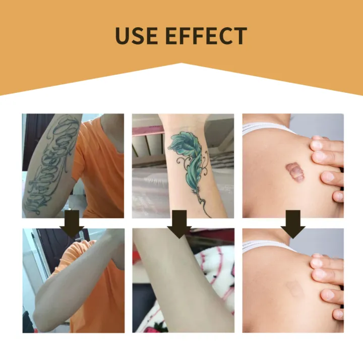 6PCS%20Tattoo%20Cover%20Up%20Skin%20Color%20Scar%20Concealer%20Sticker%20Portable%20Flaw%20Birthmark%20Concealing%20Waterproof%20Beauty%20Cosmetic%20Tools%20-%20Image%205