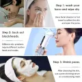HEGRUS Electric Bubble Blackhead Remover Small Vacuum Suction Acne Extractor Pores Deeply Cleaning USB Rechargeable Water Cycle Pore Acne Pimple Removal Facial Cleaning Tool with 6 Tips. 