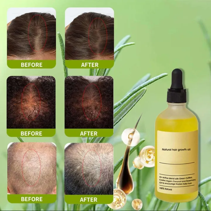 Heykeratin%20Oil,%20Hey%20Keratin%20Natural%20Hair%20Growth%20Oil%20Black%20Women,%20HairOil%20Rosemary%20Drops%20for%20Dry%20Damaged%20Hair(2%20bottles)%20-%20Image%203